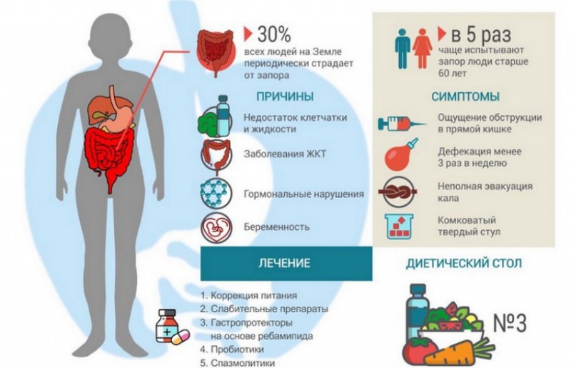 Причины и лечение запора